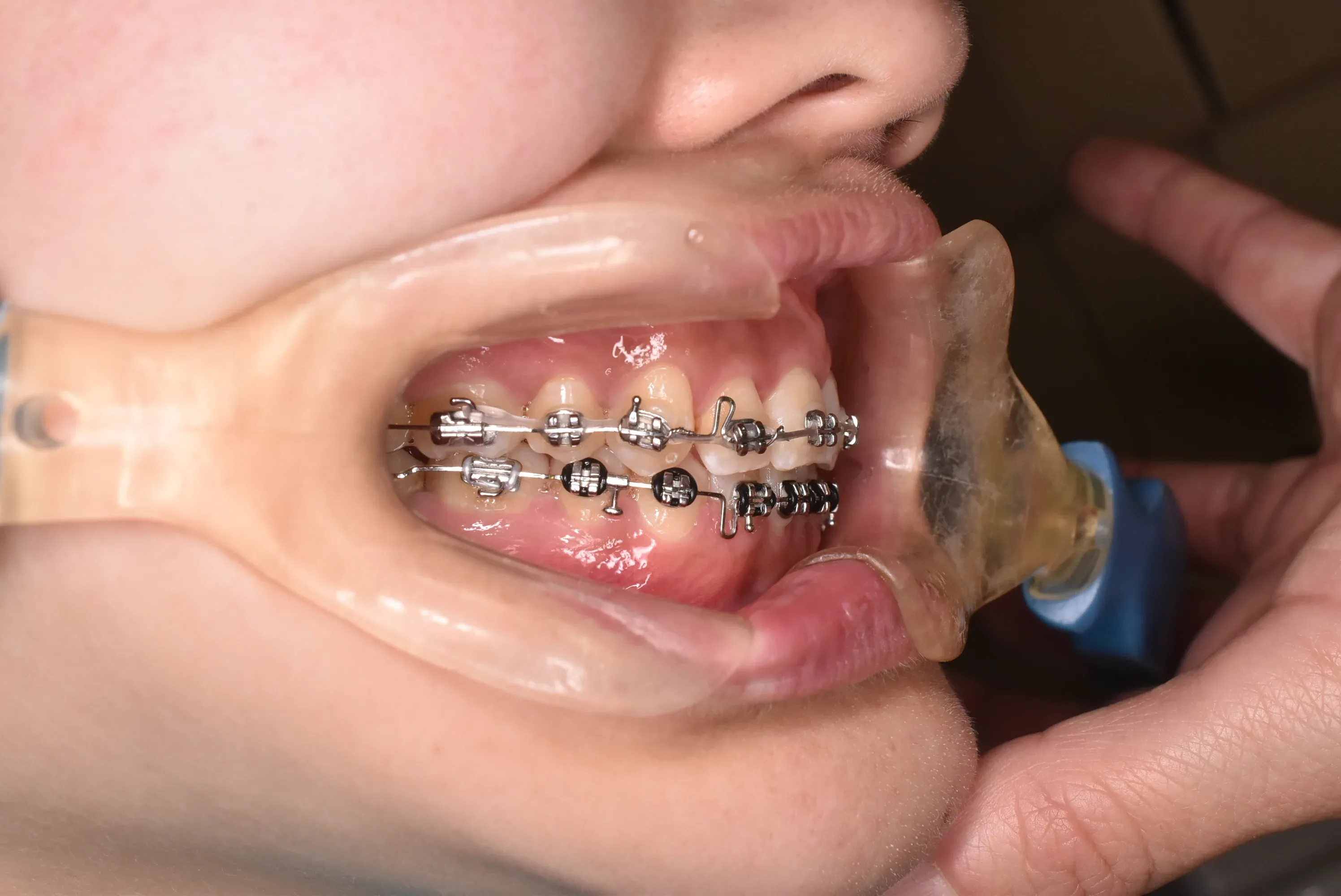 DSC_0208 | ソフィア歯列矯正歯科医院ソフィア歯列矯正歯科医院